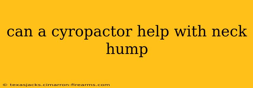 can a cyropactor help with neck hump