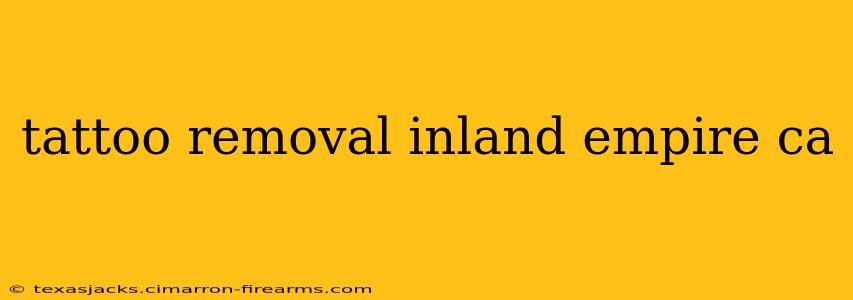 tattoo removal inland empire ca